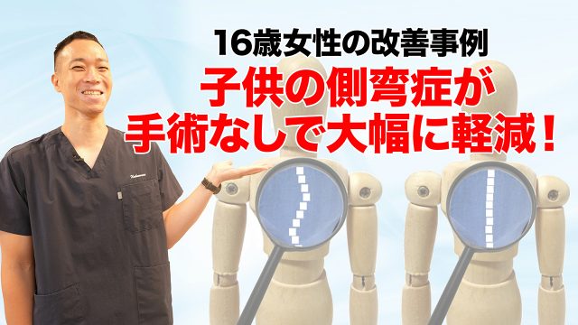 子供の側弯症が手術なしで大幅に軽減！30度以上の側弯症が17度まで矯正できた16歳女性の事例
